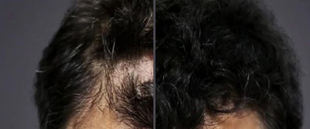 before-vs-after